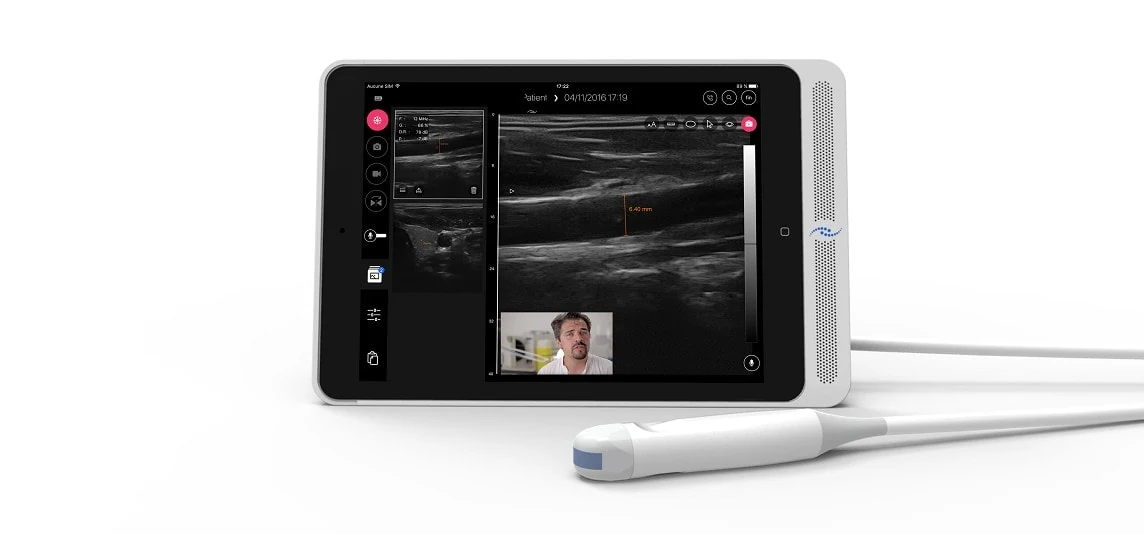 OSCULT — échographe portable connecté sur iPad avec sa sonde